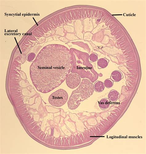 Ascaris Lumbricoides Labeled