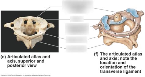 Atlantoaxial Joint Diagram Quizlet