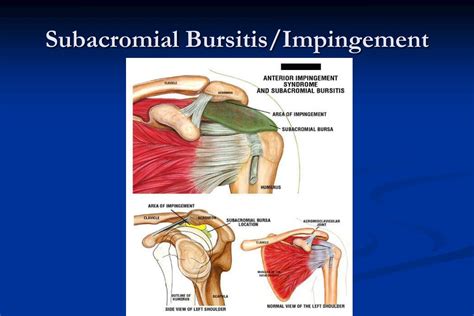 Ppt The Shoulder Powerpoint Presentation Free Download Id1182099