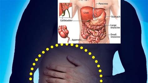 Waspadai Sakit Perut Di Sebelah Kanan Baik Atas Atau Bawah Bisa Jadi