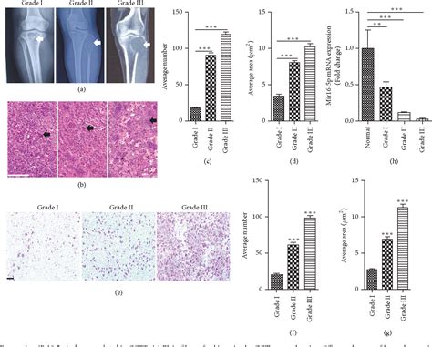 Figure From Microrna P Inhibits Osteoclastogenesis In Giant Cell