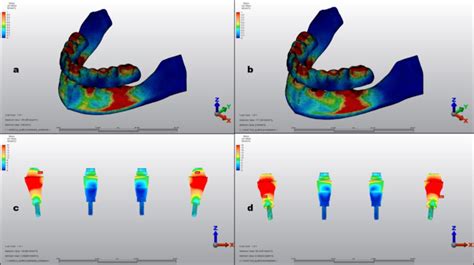 Areas Where Stress Is Concentrated In Model 1 A And Model 2 B And Download Scientific