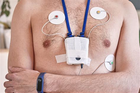 Hour Holter Monitoring Hurstville Private Heart Centre