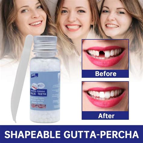 Gutta Percha Fill A Tooth Temporary Tooth Repair Kit Filling Teeth Gaps