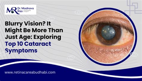 Top 10 Cataract Symptoms