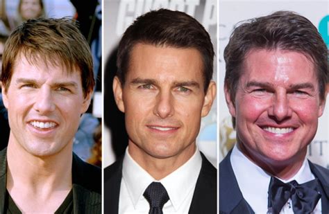 Chirurgie esthétique et Tom Cruise voici toute la vérité sur cette