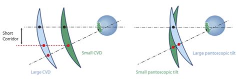 What Is The Pantoscopic Tilt Measurement Trend Optic