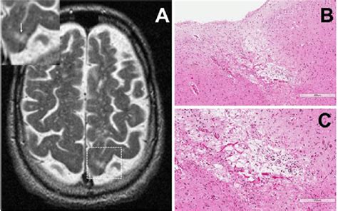 Representative Axial T Weighted Magnetic Resonance Imaging Mri