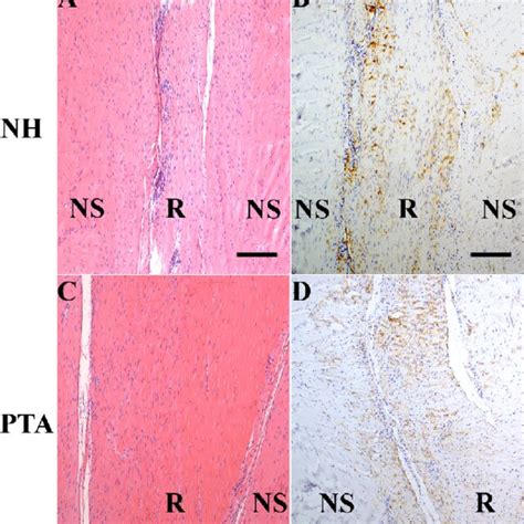 H E Staining And IHC Staining For Collagen Type III Col3 Of The