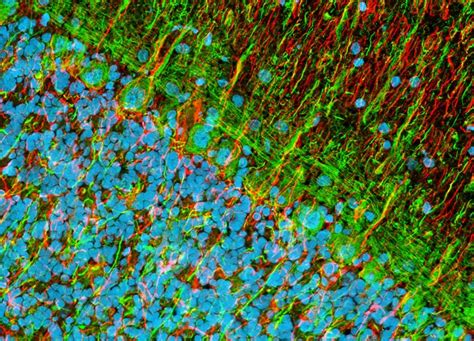 Distribution Of Neurofilament Protein And Glial Fibrillary Acidic