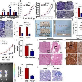 Overexpression Of Circstk Inhibits The Proliferation Migration And