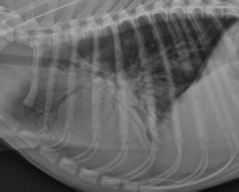 Lung Radiography Flashcards Quizlet