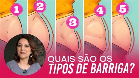 Diástase Abdominal Pós Parto e Tipos de Barriga YouTube