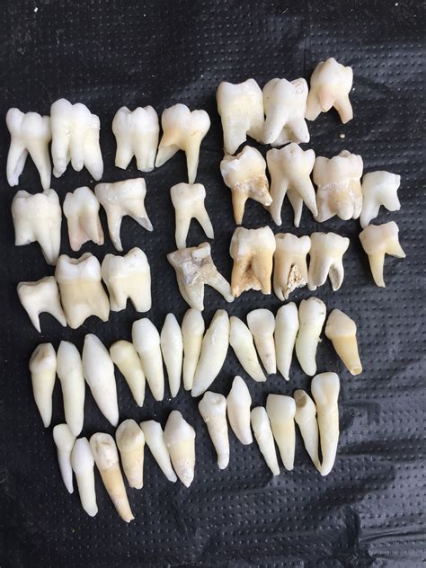 Real Human Teeth