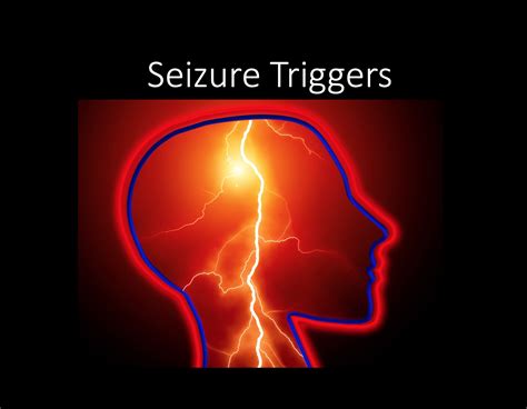 sneaky seizure triggers pearls pitfalls emdocs