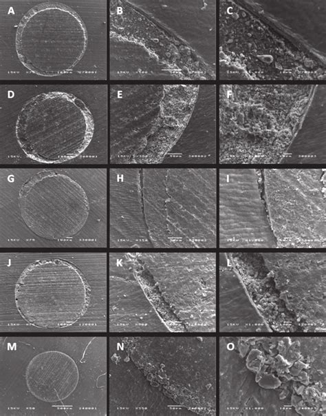 Scanning Electron Microscopy Photomicrographs Of Fiber Post Cement And