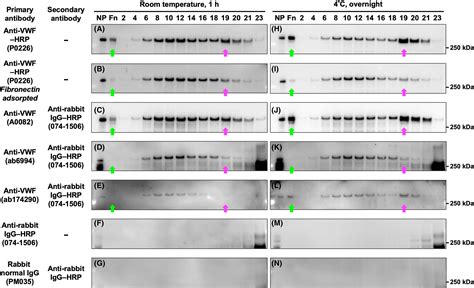 Commonly Used Antivon Willebrand Factor Antibody For Multimer Analysis