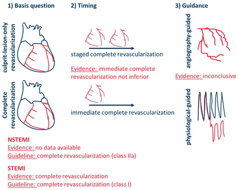 Jcm Free Full Text Revascularization Strategy In Myocardial