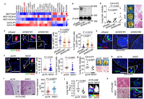 长链非编码rna Nr2f1 As1通过调控nr2f1和Δnp63 诱导乳腺癌肺转移性休眠