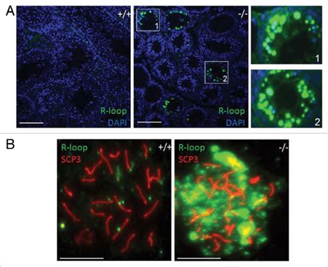 Accumulation Of R Loops In Setx Germ Cells A Immunostaining Of