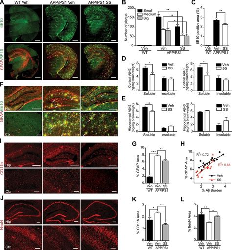 SS treatment alleviates Aβ levels and amyloid plaque burden reduces