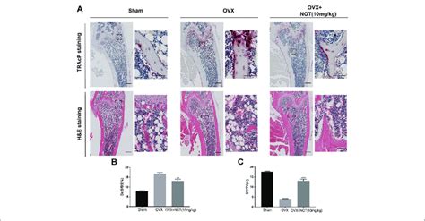 Notopterol Ameliorates Ovx Induced Bone Loss By Suppressing