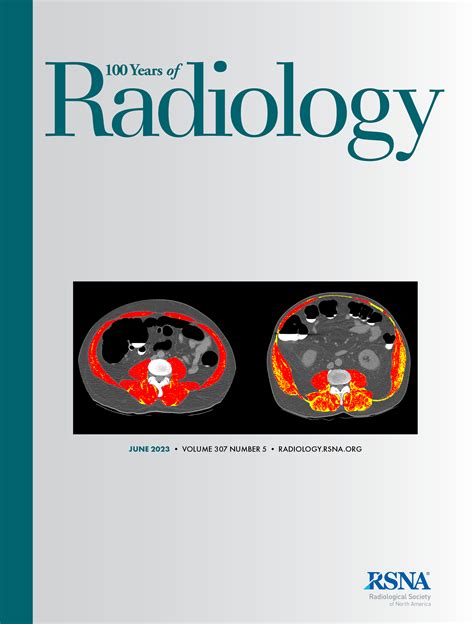 Case 314 Cerebral Proliferative Angiopathy Radiology