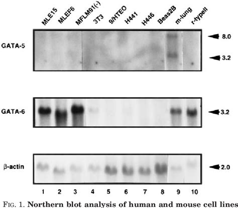 Figure 1 From GATA 6 Activates Transcription Of Thyroid Transcription