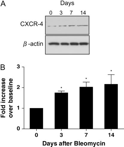 Figure From Role Of The Sdf Cxcr Axis In The Pathogenesis Of Lung