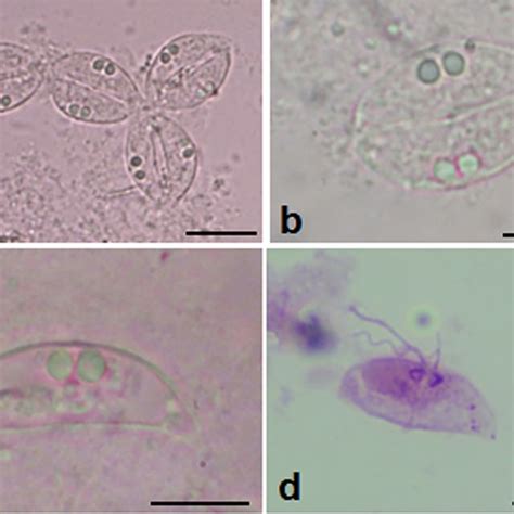 Photomicrographs Of Ceratomyxaaenei N Sp From The Gallbladder Of