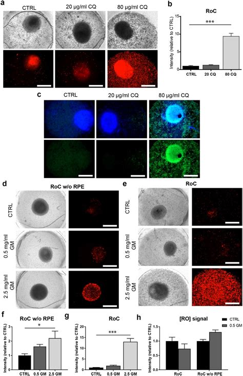 Figures And Data In Merging Organoid And Organ On A Chip Technology To