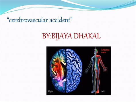 Cerebrovascular Accident Ppt