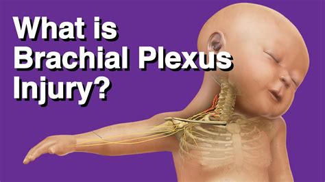 Brachial Plexus Injury Awareness