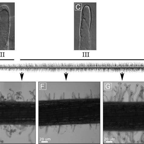 Overview Of The Nodulation Process In Plants That Form Indeterminate