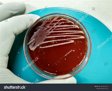 Bacteria Colony Blood Agar Medium Culture Stock Photo 2055673133