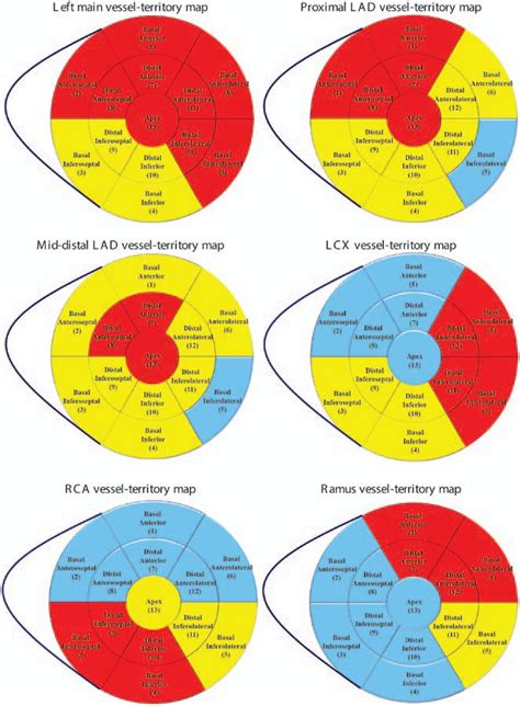 Aligning Coronary Anatomy And Myocardial Perfusion Territories