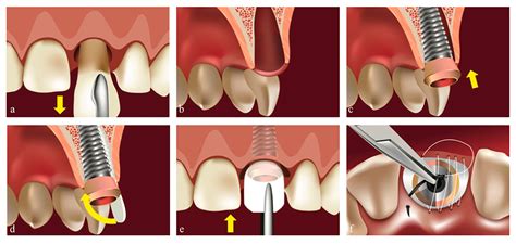 Biology Free Full Text Open Healing A Minimally Invasive Protocol