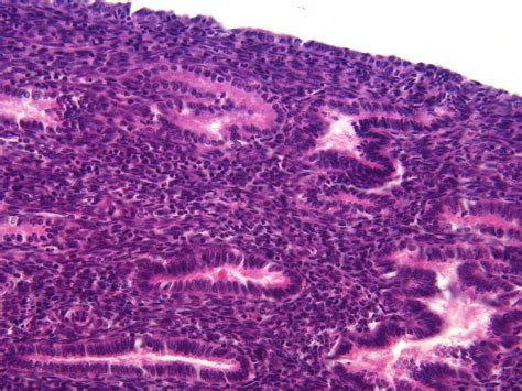 Uterus Early Proliferative Phase 400 X Anatomicum