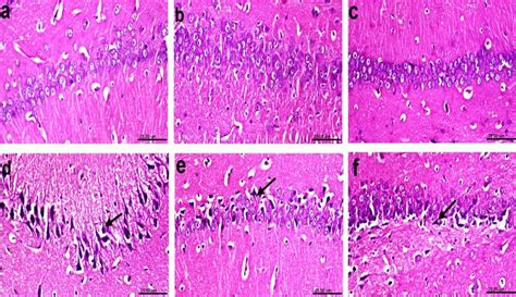 Histological H E Stained Sections Of CA1 Region Of The Hippocampus A