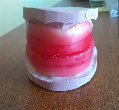 Complete Dentures Dental Elementary