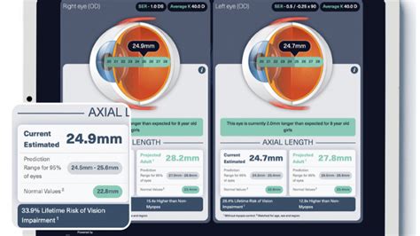 Tools Supporting Myopia Management