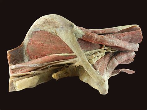 Sagittal Section Female Pelvis