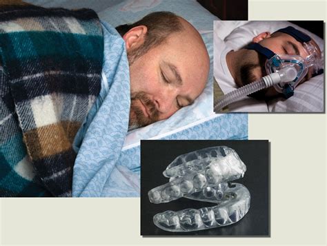 Small device helps sleep apnea sufferers in a big way | Mission ...