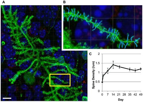 Purkinje Cell Spine Density Analysis Stability In Uninfected