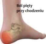 B L Pi Ty Przy Chodzeniu Pod Spodem Z Ty U Poradnik