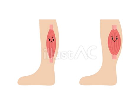 ふくらはぎの筋肉のイラスト素材12イラスト No 23483876／無料イラスト フリー素材なら「イラストac」