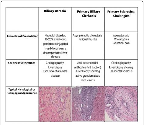 Primary Sclerosing Cholangitis Histology