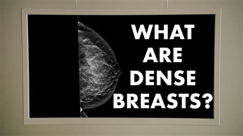 What Are Dense Breasts Youtube