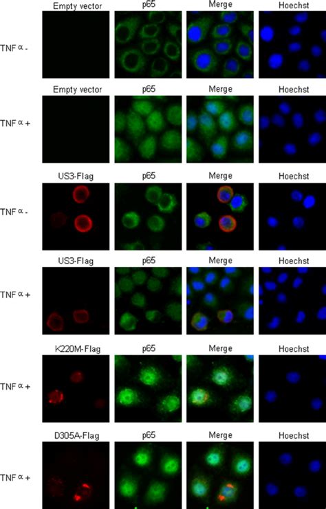 Us Prevents P Nuclear Translocation Hela Cells Were Transfected