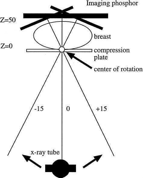 Stereotactic Localization Of Breast Lesions How It Works And Methods To Improve Accuracy